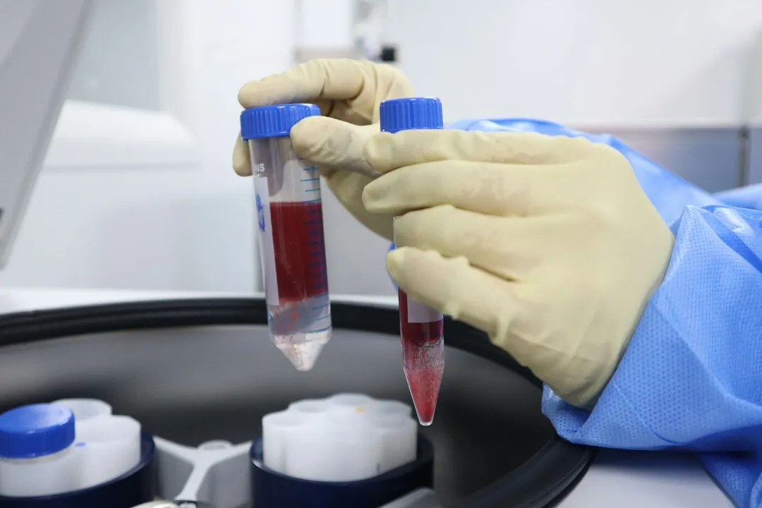 甲状腺结节多学科评估体系与个体化干预方案解析正文配图 2